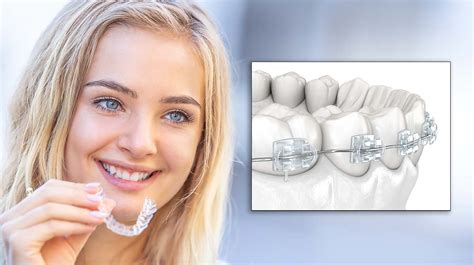 Clear Braces Vs Invisalign Elara Orthodontics