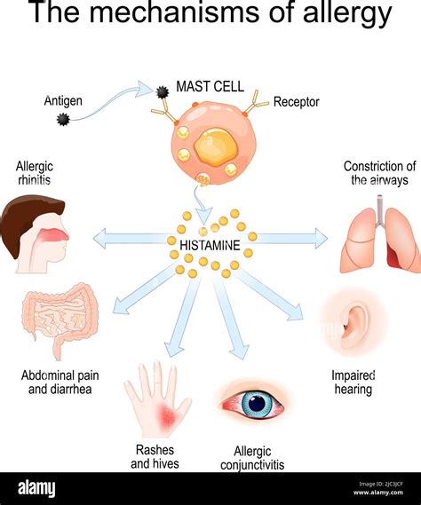 Mechanism Of Allergy Mast Cells And Allergic Reaction Histamine