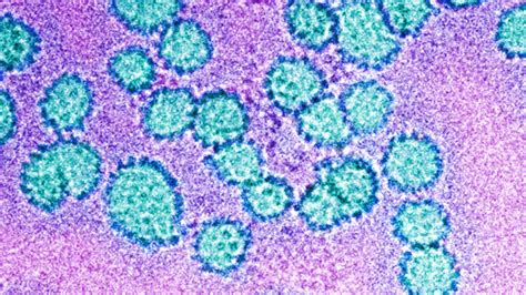 1 In 4 Us Men Have Cancer Linked Hpv Genital Infections Necn