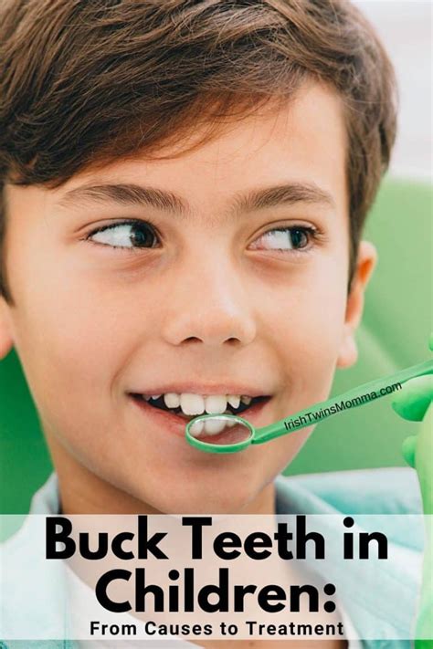 Buck Teeth In Children From Causes To Treatment The Irish Twins Momma