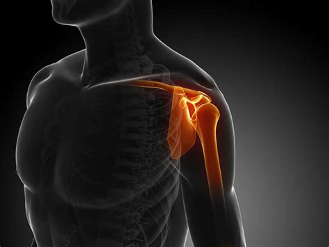 Arm Pain 10 Causes Of Arm Pain
