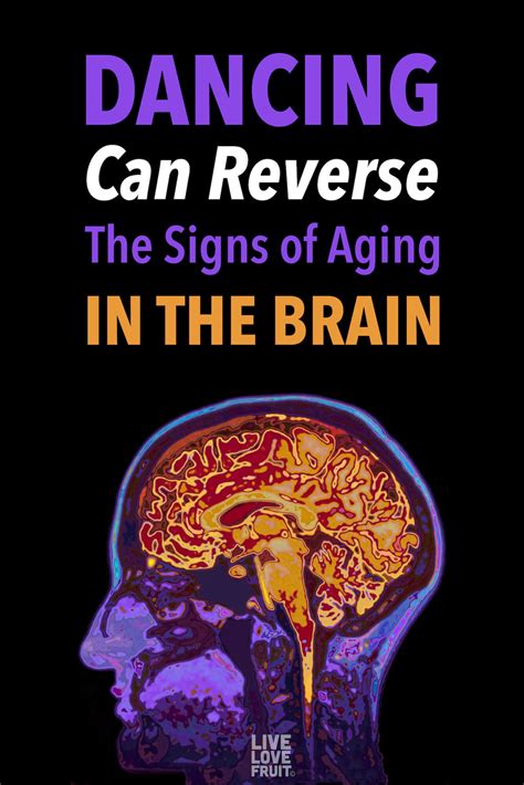 Dancing Can Reverse The Signs Of Aging In The Brain Brain Health