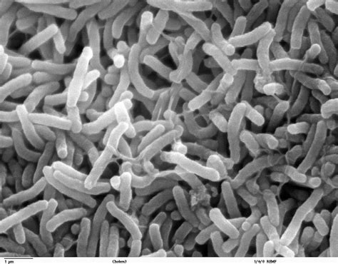 Scientific Image Cholera Bacteria Nise Network