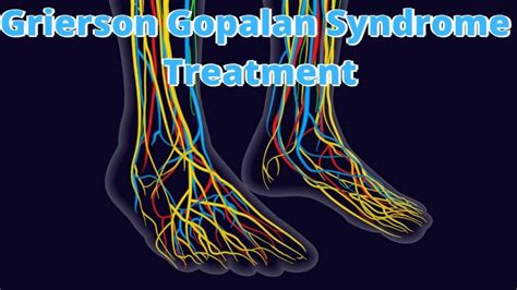 What Is Grierson Gopalan Syndrome Causes And How To Treat It