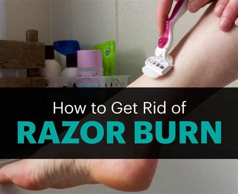 How To Get Rid Of Razor Burn Razor Burns Razor Burn Treatment Razor Bumps