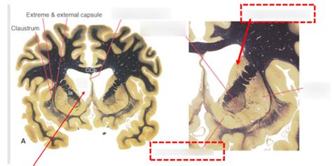 Rostral Brain Slice Diagram Quizlet