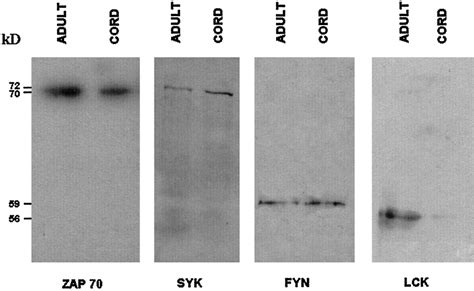 Western Blot Analysis Of Zap70 Syk Lck And Fyn Expression Equal