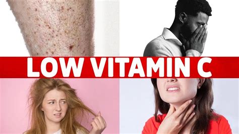 Signs Of A Vitamin C Deficiency You Ve Never Heard About Youtube
