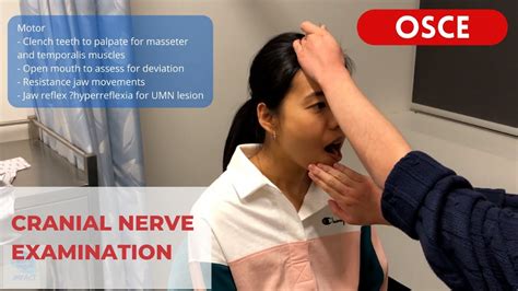 Osce Video Series Cranial Nerve Examination Teaching For Impact
