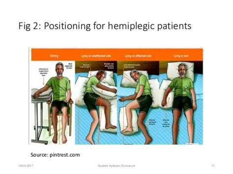 Prevention And Management Of Hemiplegic Shoulder Pain Among Stroke Su