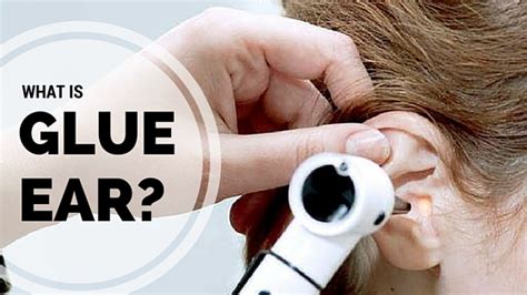 What Is Glue Ear Healthy Hearing Blog