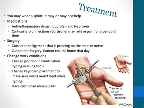 Ppt Carpal Tunnel Syndrome Powerpoint Presentation Free Download