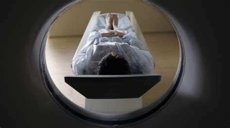 Sometimes known as a cat scan, these procedures can help diagnose conditions such as damaged bones or injuries to internal organs. How Much Does a CT Scan Cost?