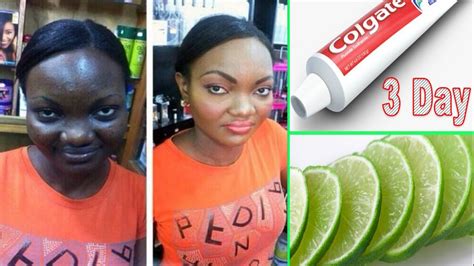 How To Whitening Your Skin At Home With Lemon And Aloe Vera Face
