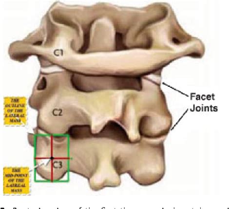 Pdf Lateral Mass Fixation In Subaxial Cervical Spine Anatomic Review