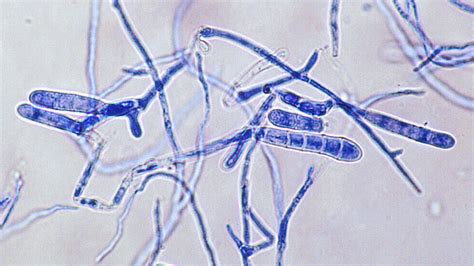 Dermatophytes Under Microscope