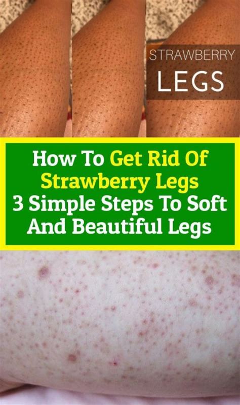 How To Get Rid Of Strawberry Legs 3 Simple Steps To Make Legs Soft And