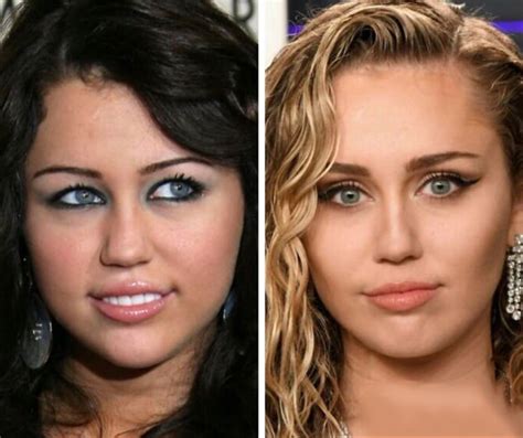 Miley Cyrus Nose Job Celebrity Surgery Miley Cyrus Nose Job