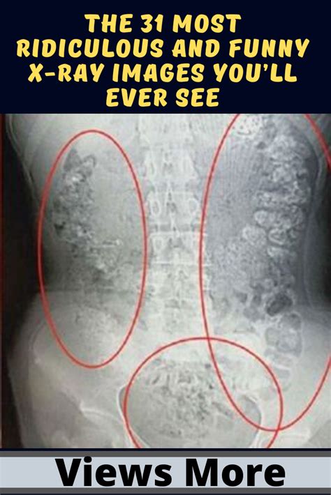 The 31 Most Ridiculous And Funny X Ray Images Youll Ever See