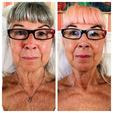 How To Improve Chest And Throat Wrinkles And Sleep Better In Just Seven Days — Alternative Ageing
