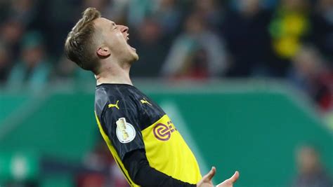Reus To Miss Champions League Games With Psg After Borussia Dortmund