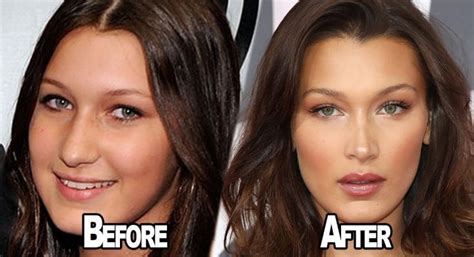 Gigi Hadid Before And After Plastic Surgery Including Nose Job And Boob