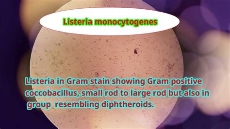 Listeria Monocytogenes Under Microscope Youtube