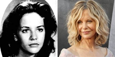 Meg Ryan S Plastic Surgery Face Before And After Photos