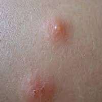 Red spots on skin pictures. Can Dry Skin Cause Itchy Bumps? Skin Conditions with Dry ...