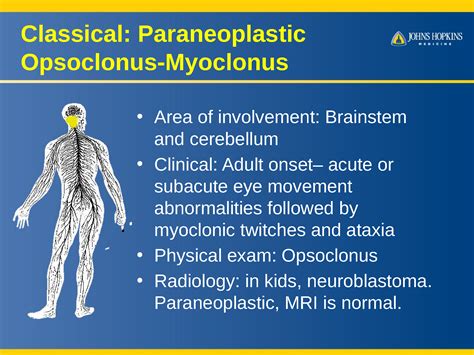 Paraneoplastic Neurological Disorders What You Need To Know