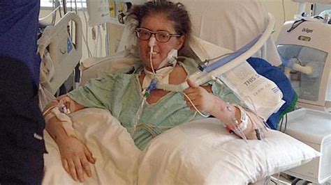 Canadian Woman S Life Saved By Removing Her Lungs For Six Days Information Nigeria