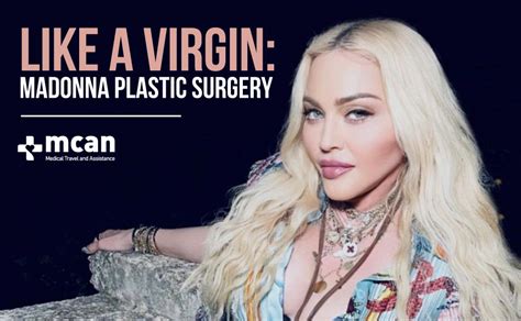 Madonna Plastic Surgery Facts All About Her Operations