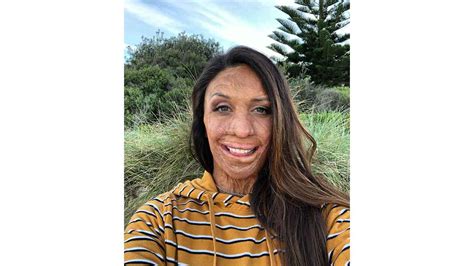 This Is What I Remember Turia Pitt Reflects Years After Fateful Day OverSixty