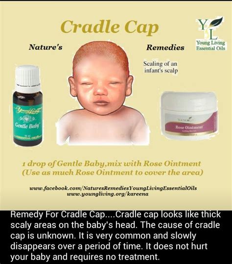 What Is The Best Treatment For Cradle Cap