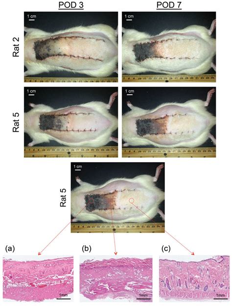 The Development Of Skin Flap Necrosis During The Post Operative Period