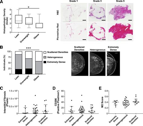Obesity Associated Extracellular Matrix Remodeling Promotes A