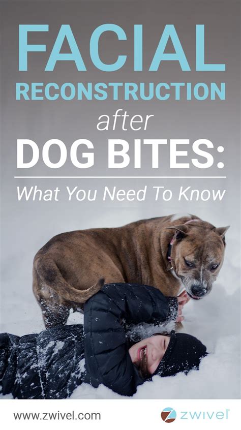 Preventing Dog Bite Injuries A Guide For Families