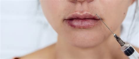 How Long Does Lip Filler Swelling Last Mid Atlantic Skin Surgery