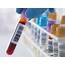 What Is Included In A Blood Drug Test For Employment