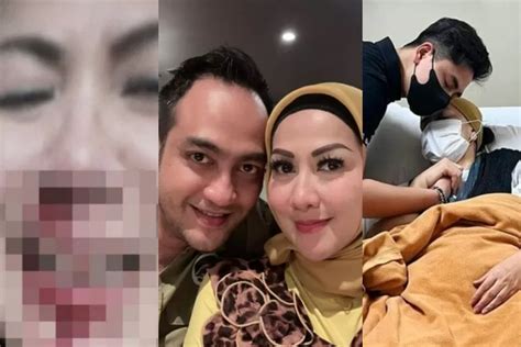 Fakta Venna Melinda Alami Kdrt Kronologi Terungkap Gugat Cerai Suami Ferry Irawan Jadi
