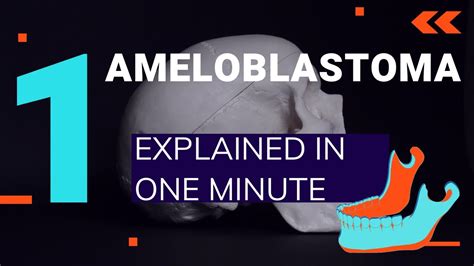 Ameloblastoma Explained In One Minute Afk Acj Inbde Adc Written Osce Youtube