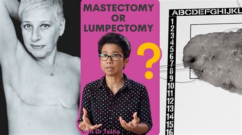 Mastectomy Or Lumpectomy With Dr Tasha Youtube