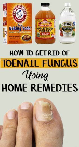 47 Cool Strong Home Remedies For Toe Fungus Home Decor Ideas