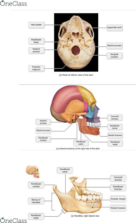 Zygomatic Arch Anatomy Anatomical Charts And Posters