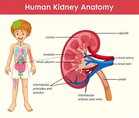 Free Vector Kidney Stones Disease Cartoon Style Infographic