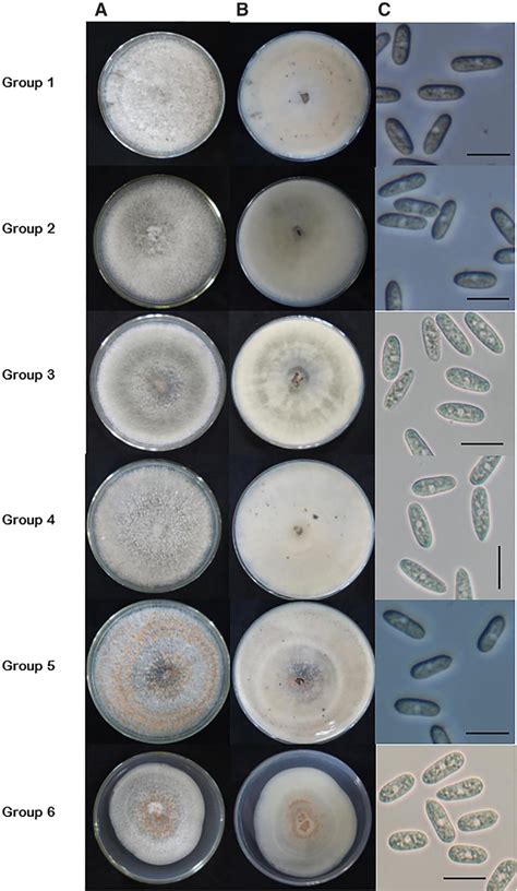 Morphological Characteristics Of Colletotrichum Spp Isolated From