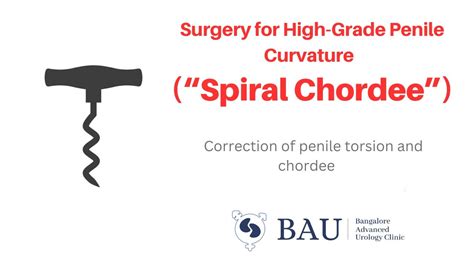 High Grade Penile Curvature Penile Torsion With Chordee Spiral