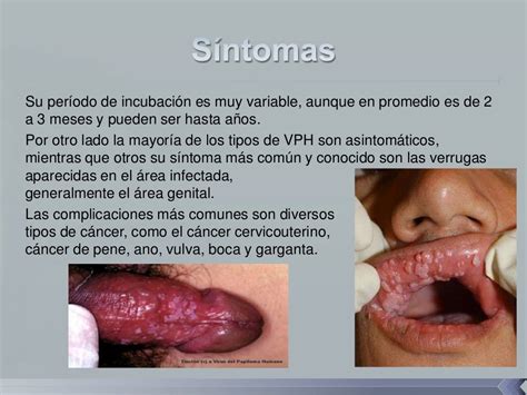 Del Papiloma Humano Vph Fotos Slideshare Virus Del Papiloma Humano