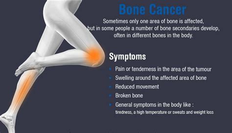 Sri Sri Cancer Care On Twitter Symptoms Of Bone Cancerpain Or