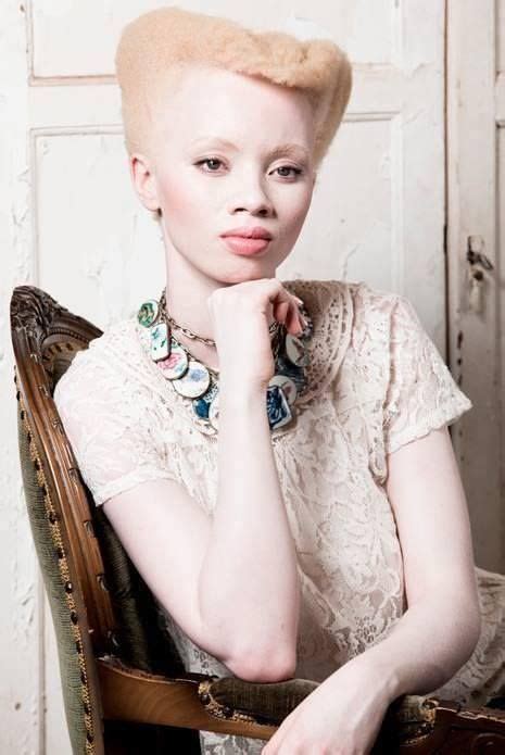 15 Albino Women And Girls With Gorgeous Natural Hair Gallery